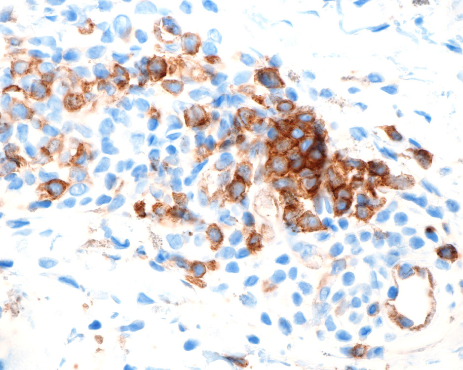 CD123